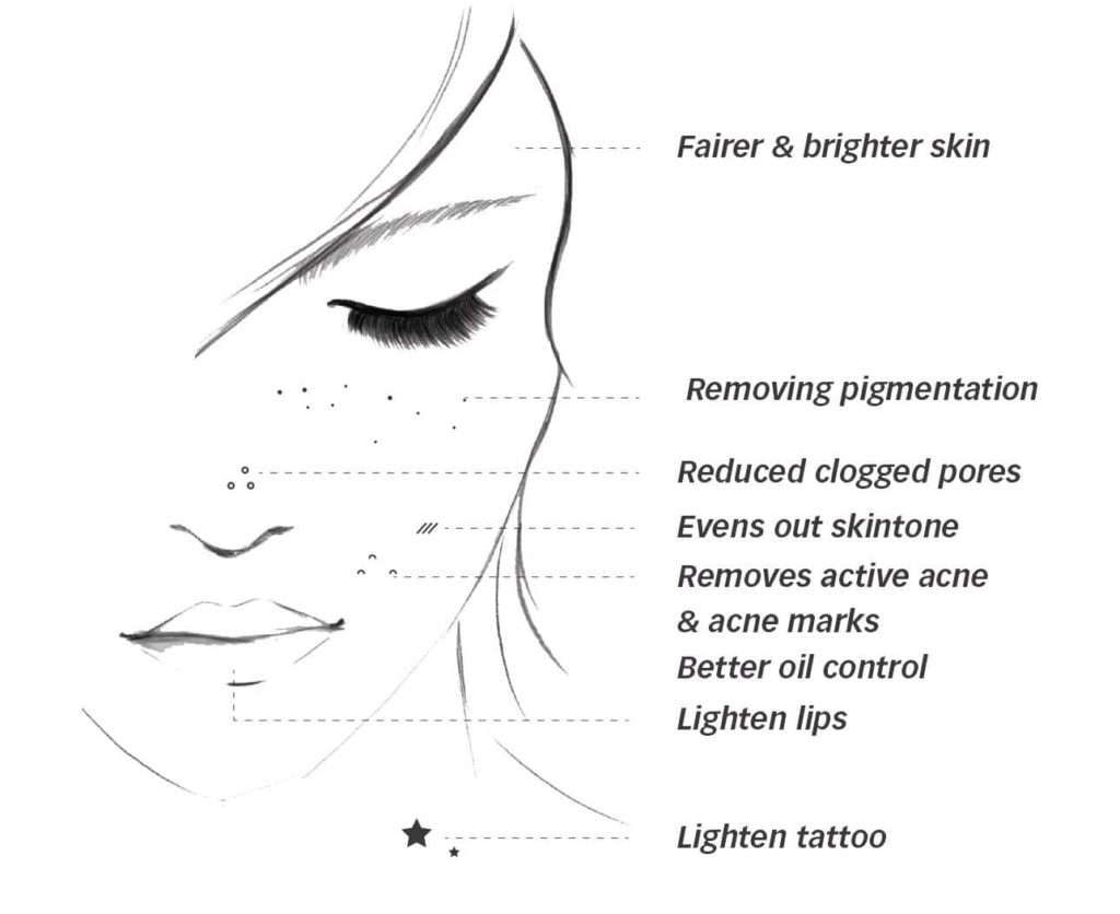 Q Switched laser dubai